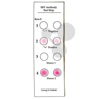 Test HIV