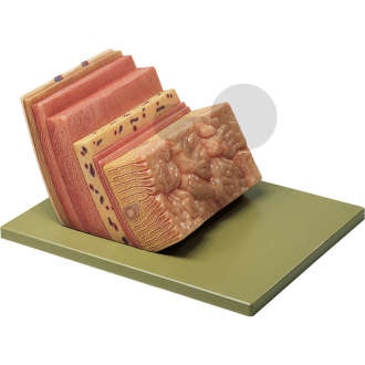 Magenwand SOMSO®-Modell